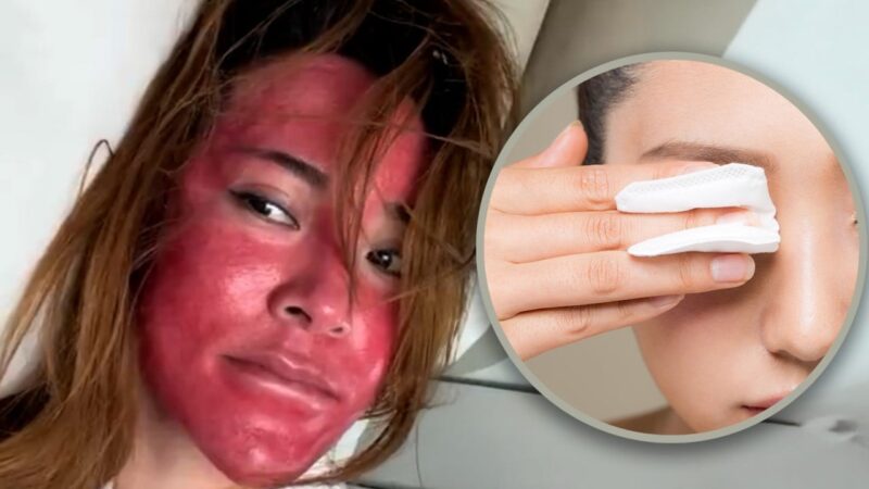 Chinese woman wears same make-up for 22 years, leads to severe allergic reactions