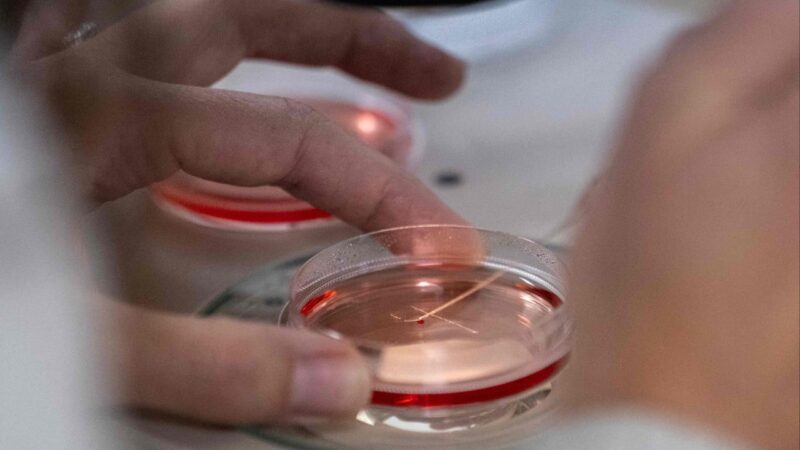 Israeli pioneer in lab-grown kidneys seeks China biotech funding