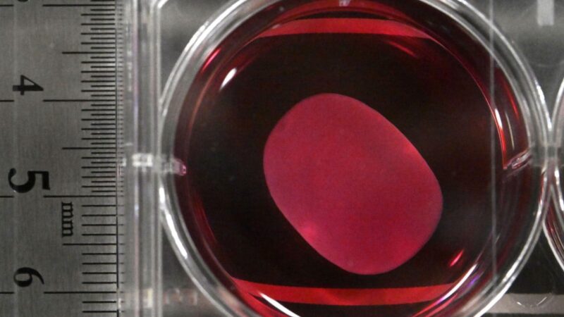 Japan approves world’s first regenerative medicines using iPS cells