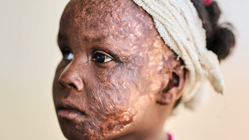 Sudan’s RSF committed ethnic cleansing, says Amnesty